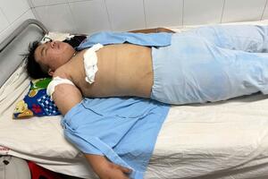 Bình Định: Nam thanh niên bị đâm trọng thương trên đường về nhà