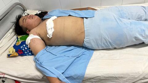 Bình Định: Nam thanh niên bị đâm trọng thương trên đường về nhà