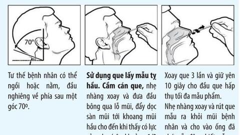Những lưu ý khi tự test nhanh Covid-19 tại nhà