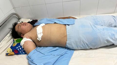 Bình Định: Nam thanh niên bị đâm trọng thương trên đường về nhà